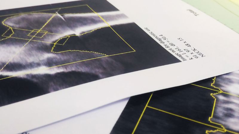 Indikace k vyšetření