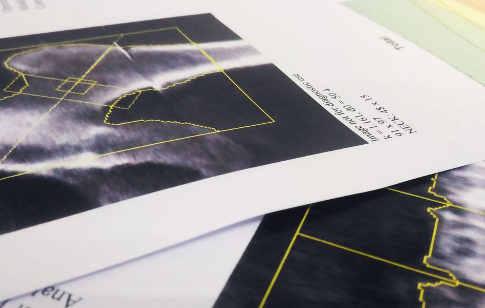 Indikace k vyšetření